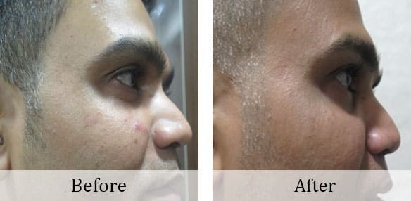 Injectable-treatment (4)